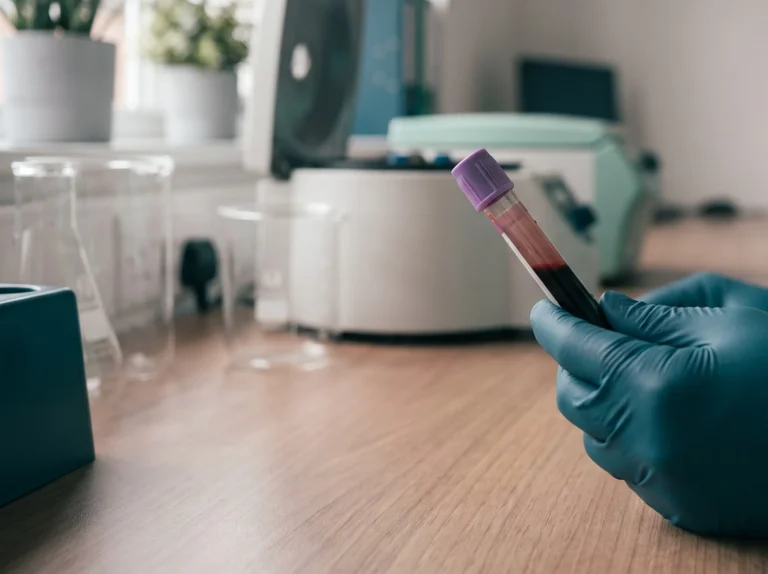 Gloved hand holding a blood sample tube